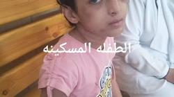 قصة تعذيب "هبة" على يد زوجة أبيها.. ضرب مبرح وكي بالسكين الساخن