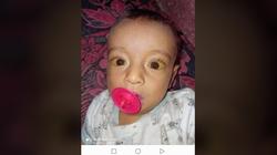 صورة.. مستشار رئيس الوزراء يؤكد الاستجابة لحالة الطفل ياسين