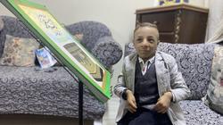 أحمد يحارب ضمور المخ والعضلات ويعشق التمثيل.. طوله 70 سنتيمترا