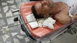 استخراج سيخ حديدي اخترق جسد عامل في جامعي طنطا