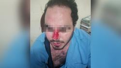أصيب بكسر في الأنف.. أهالي مريض يعتدون على طبيب بـ"طنطا الجامعي"
