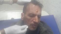 "الوطن" تنشر صورة المواطن المصاب في حادث تفجير "مدرعة العريش"