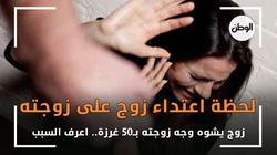 «بـ50 غرزة» لحظة اعتداء زوج على زوجته وتشويه وجهها.. اعرف السبب