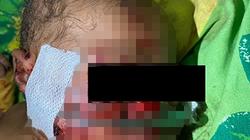 صدمة الولادة تدفع أم أوغندية لدفن رضيعتها.. خرجت حية بعد 6 ساعات