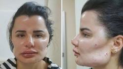بالصور| لا تذهب هذه العيادة.. طبيب تجميل برازيلي يحول مرضاه لمسوخ