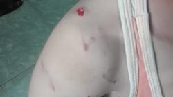في مهاجمة شرسة بـ"الطوب" طفل ينقذ نجل عمه من كلب.. والأم: "عمر جديد"