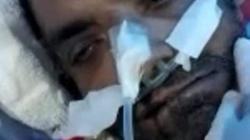 يحتاج طائرة لنقله.. «مصري» في نيجيريا أصيب بفشل كلوي و«ملاريا وتيفود»