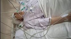 كسر راسه بـ«التختة».. طالب يعتدي على زميله بالمدرسة ويصيبه بجروح خطيرة