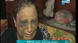 بالفيديو| سيدة تروي واقعة ضربها بالسنج على يد أبنائها