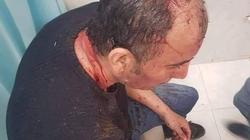 محامى نيابات المنتزه يأمر بضبط وإحضار معتدين على محصل كهرباء