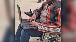 محمود يتحدى «الضمور» بالأدب و«فوتوشوب»: حلمي أكون كاتب كبير