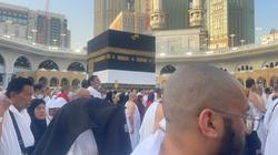 الأزهر: إزالة المحرم لشعره أو أظفاره عمدا تستوجب الفدية