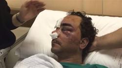 المصري المعتدى عليه في الكويت يروي الواقعة لنيابة العاصمة