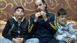 أول ظهور لطفلي الوجه المتضخم بعد مرور عام: العملية نجحت وشكلهم اتغير «فيديو»