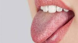 قدمه قربانا للإلهة "كالي ماتا".. هندوسي يقطع لسانه لإيقاف تفشي كورونا
