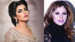 بالصور| 7 مذيعات عرب يظهرن بشكل مختلف بعد عمليات التجميل
