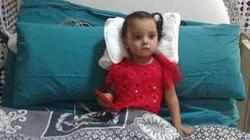 "جراحة نادرة".. تركيب صمام حيواني في قلب رضيعة بمستشفى أطفال المنصورة