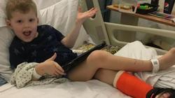 حالة مرضية نادرة لطفل لا يشعر بأي ألم.. «نقمة وليست نعمة»