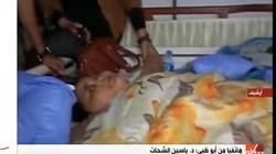 بالفيديو| مدير مستشفى "برجيل" بأبوظبي: تحسن حالة أسمن فتاة في العالم