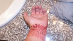على الأصل دور.. "اقطع عرق وسيح دم"