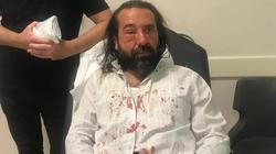 فيديو وصور| اعتداء غاشم لأنصار أردوغان على رجل أعمال معارض