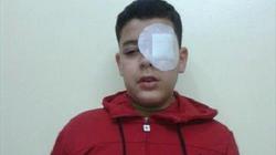 طالب تدخل لفض مشاجرة فأصيب في عينيه داخل مدرسة بطنطا