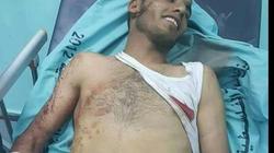 صورة| شهيد فلسطيني مبتسما بعد وفاته