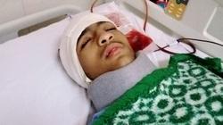 عامل ينفق كل ما يملك لعلاج ابنه من ورم بالمخ: «مش هيرجع زي الأول»