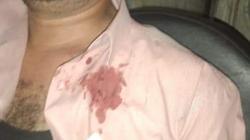 تفاصيل اعتداء مجهولين على قائد قطار إدفو.. «ساق وهو بينزف» (صور)