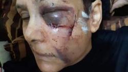 "عيوشة" ضحية الابن العاق: "ضربني عشان الورث.. عايزة حقي"