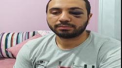  تـفاصيل الاعـتداء على فني أشعة الغربية.. «ضربوه بالعكاز في عينه»