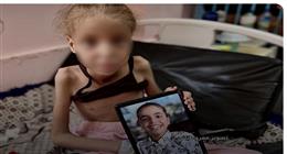 «هدى» طفلة فلسطينية تصارع الموت بسبب سوء التغذية.. وزنها بلغ 19 كيلوجراما