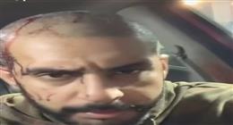 كمين الدم على الطريق.. سائق تطبيق ذكي ينجو من طعنات الغدر و«الداخلية» تضبط الجناة