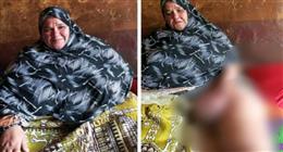 «الحاجة عايدة» سجينة في جحيم داء الفيل منذ 15 سنة بالشرقية.. وتستغيث لعلاجها