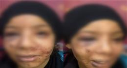 أرض زراعية ومحاولة لخلع عينيها.. القصة الكاملة للاعتداء على طفلة بلبيس