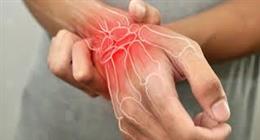 التهاب المفاصل الجوال.. كيف يختار جهازك المناعي هدفا جديدا في جسدك كل صباح؟