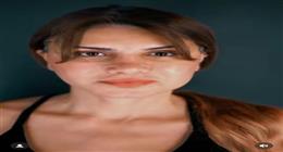 صور نجلاء بدر قبل التجميل وبعده.. القصة الكاملة