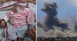 تشوهات الأجنة في غزة.. ولادة طفلة بلا دماغ والأطباء يحملون إشعاعات القصف الإسرائيلي المسؤولية 