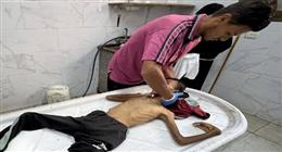 المأساة تتفاقم.. أطفال غزة يواجهون الموت جوعا