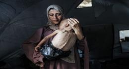 «أطفال غزة في قلب الكارثة».. سياسة التجويع تفتك بالقطاع المحاصر