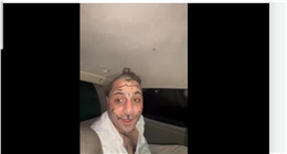 قص شعره والكتابة على جسده.. تفاصيل الاعتداء على فنان سوري بريف حلب