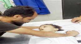 «حنان» ماتت من الجوع في غزة.. جسد صغير يحمل آلام شعب بأكمله