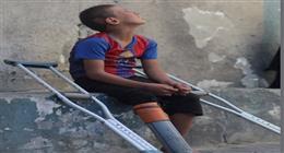 «وجع الدنيا كله».. طفل فلسطيني يستخدم ماسورة بلاستيك بدلا من الساق الصناعية