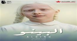 «يرصد معاناة أعداء الشمس».. حسام داغر يشارك في مهرجان مانشيستر بفيلم «البينو»