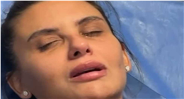 أحدثهم دانا حمدان.. أزمات المشاهير مع عمليات التجميل| عاجل