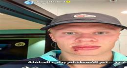 إصابة طريفة لـ«هالاند» خلال مشاركته مع منتخب النرويج.. والجمهور يمازحه: 3 غرز للباب