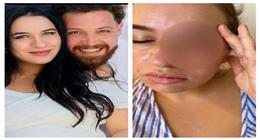 «عايزة تاخد ابني».. القصة الكاملة لأزمة اعتداء الفنان محمود حجازي على زوجته