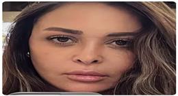 عاجل| أول ظهور لداليا البحيري بعد عملية التجميل