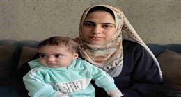 تمارا طفلة بلا جلد منذ ميلادها.. والدتها: المرض يأكل جسدها  وتحتاج لـ600 جنيه يوميا