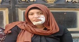 ضبط شاب وفتاة في الشرقية لاتهامهما بإصابة سيدة بجرح طعني